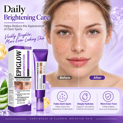 Advanced Anti-Hyperpigmentation Cream – Fade Dark Spots & Reveal Brighter, More Even-Looking Skin-HJY